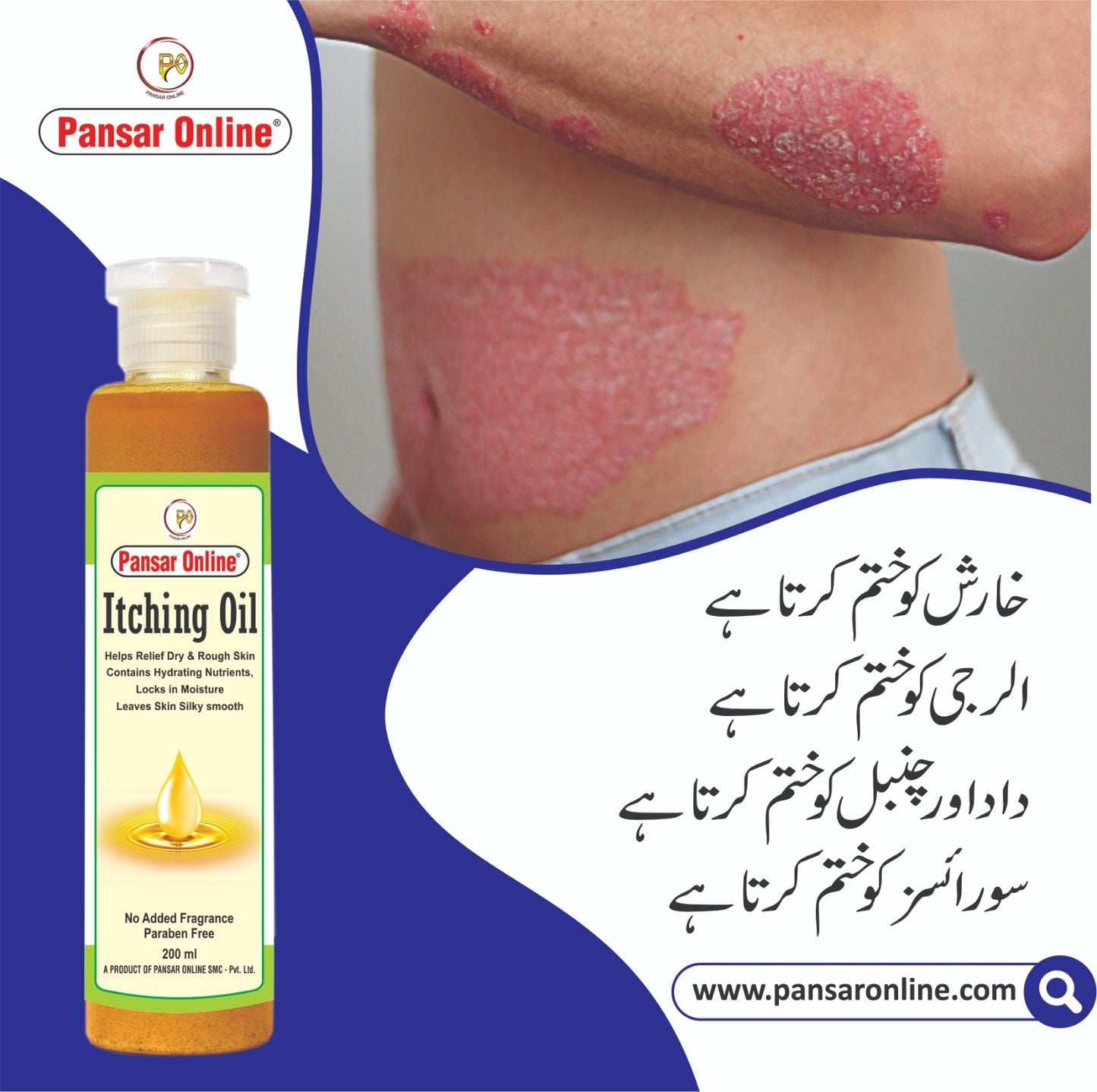 itching oil