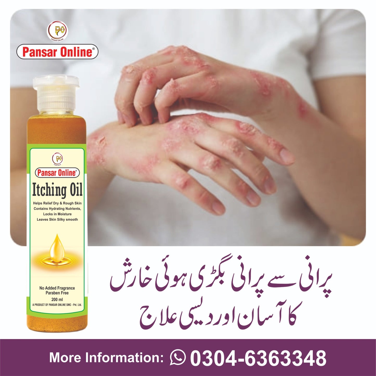 itching oil خارش چنبل اور سورائسز کے کے لئے مفید